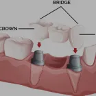 Business 2 image CHAPEL PARK DENTAL Dentists in Auckland City AUK
