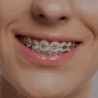Business 5 image CHAPEL PARK DENTAL Dentists in Auckland City AUK