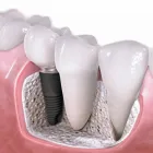 Business 6 image LANCE WEST Oral Surgeons in Auckland City AUK