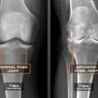 Business 2 image REFINE HEALTH Physiotherapists in Auckalnd AUK