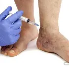 Business 1 image SKIN LOGICS Tattoo Removal in Hamilton WKO