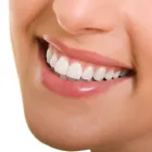 Business 6 image SPARKLEWHITE TEETH - NEW PLYMOUTH Beauty Therapy in New Plymouth TKI