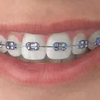 Business 3 image THE ORTHODONTIC HUB WHAKATANE Orthodontists in Whakatane BOP