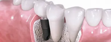 Business 6 image LANCE WEST Oral Surgeons in Auckland City AUK