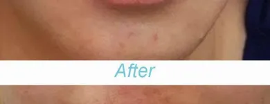 Business 1 image NOUVELLE VISAGE Tattoo-Makeup in Wellington AUK