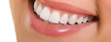 Business 6 image SPARKLEWHITE TEETH - NEW PLYMOUTH Beauty Therapy in New Plymouth TKI
