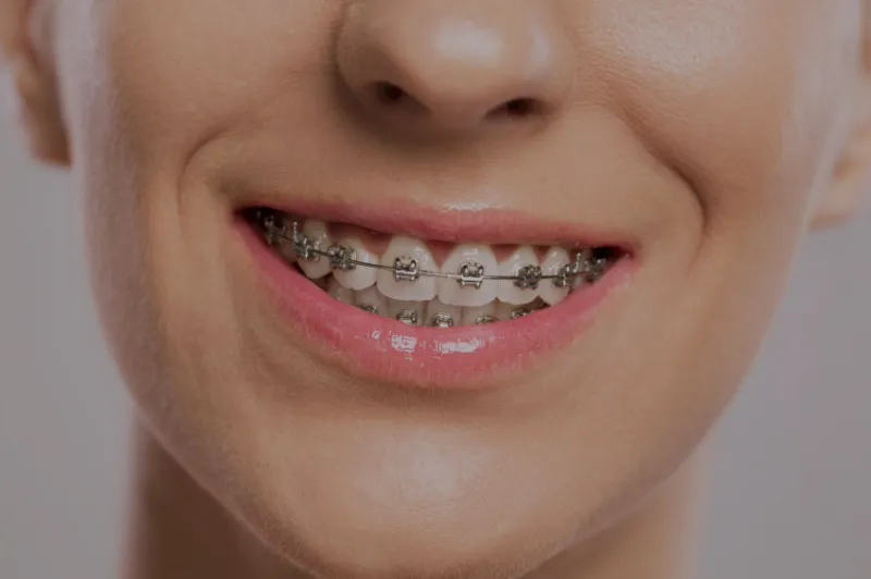 Business 5 image CHAPEL PARK DENTAL