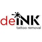 DEINK TATTOO REMOVAL
